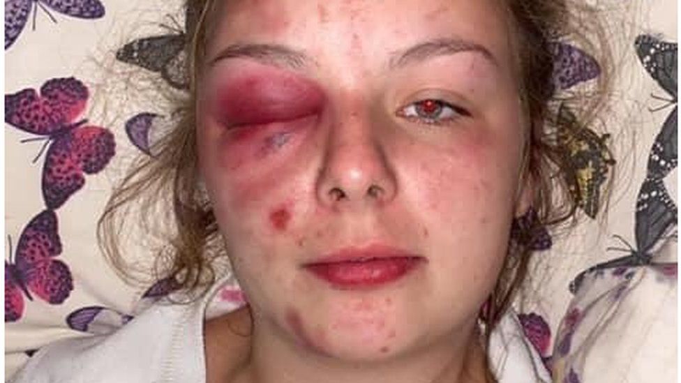 The court heard she inflicted these injuries on herself